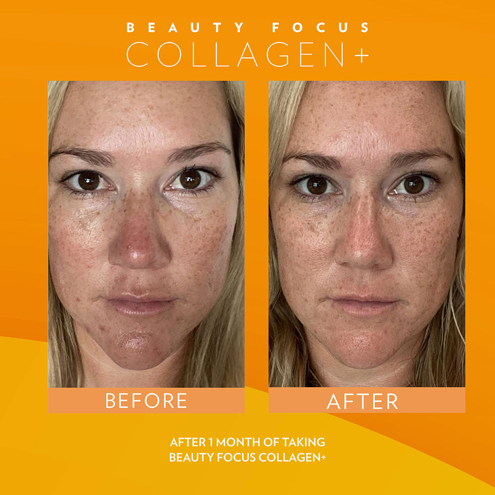 BEFORE & AFTER Beauty Focus™ Collagen+ (Peach)Buy with Regular Price* Discount will apply at checkout.  Kickstart collagen and elastin production, rev up radiance, visibly reduce fine lines and wrinkles, and bBeauty Focus™ Collagen+ (Peach)