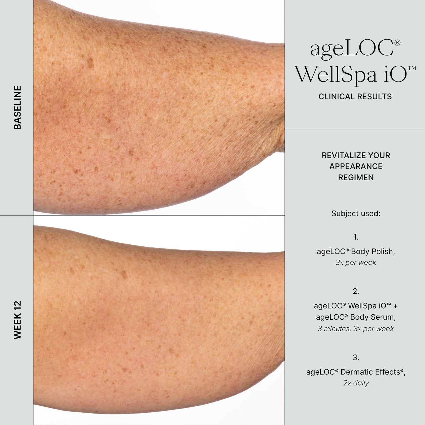 🇬🇧 Transform Your Self-Care Routine with WellSpa iO's Adaptive Microcurrent Technology - nustylemom