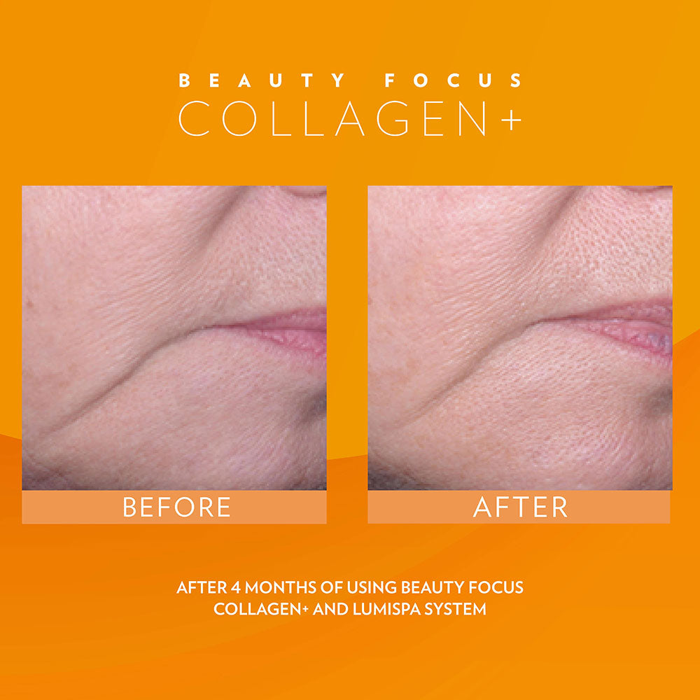 BEFORE & AFTER  Beauty Focus™ Collagen+ (Peach)Buy with Regular Price* Discount will apply at checkout.  Kickstart collagen and elastin production, rev up radiance, visibly reduce fine lines and wrinkles, and bBeauty Focus™ Collagen+ (Peach)