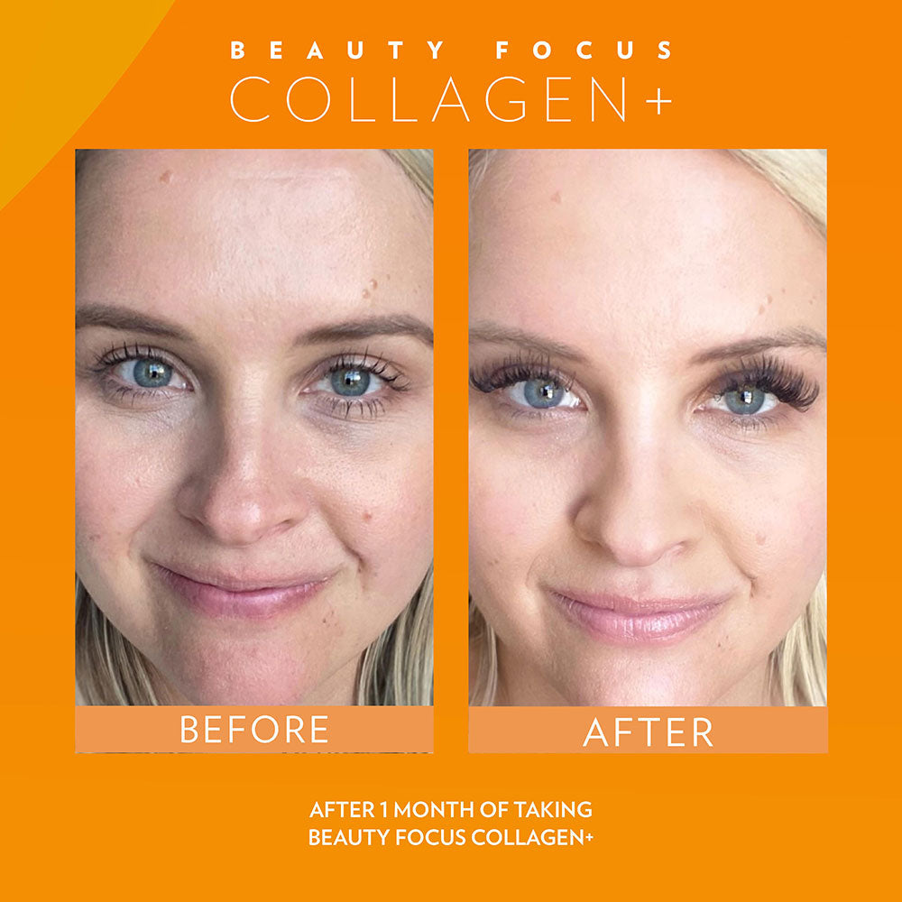 BEFORE & AFTER Beauty Focus™ Collagen+ (Peach)Buy with Regular Price* Discount will apply at checkout.  Kickstart collagen and elastin production, rev up radiance, visibly reduce fine lines and wrinkles, and bBeauty Focus™ Collagen+ (Peach)