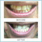 AP 24® Whitening Fluoride Toothpaste - nustylemom