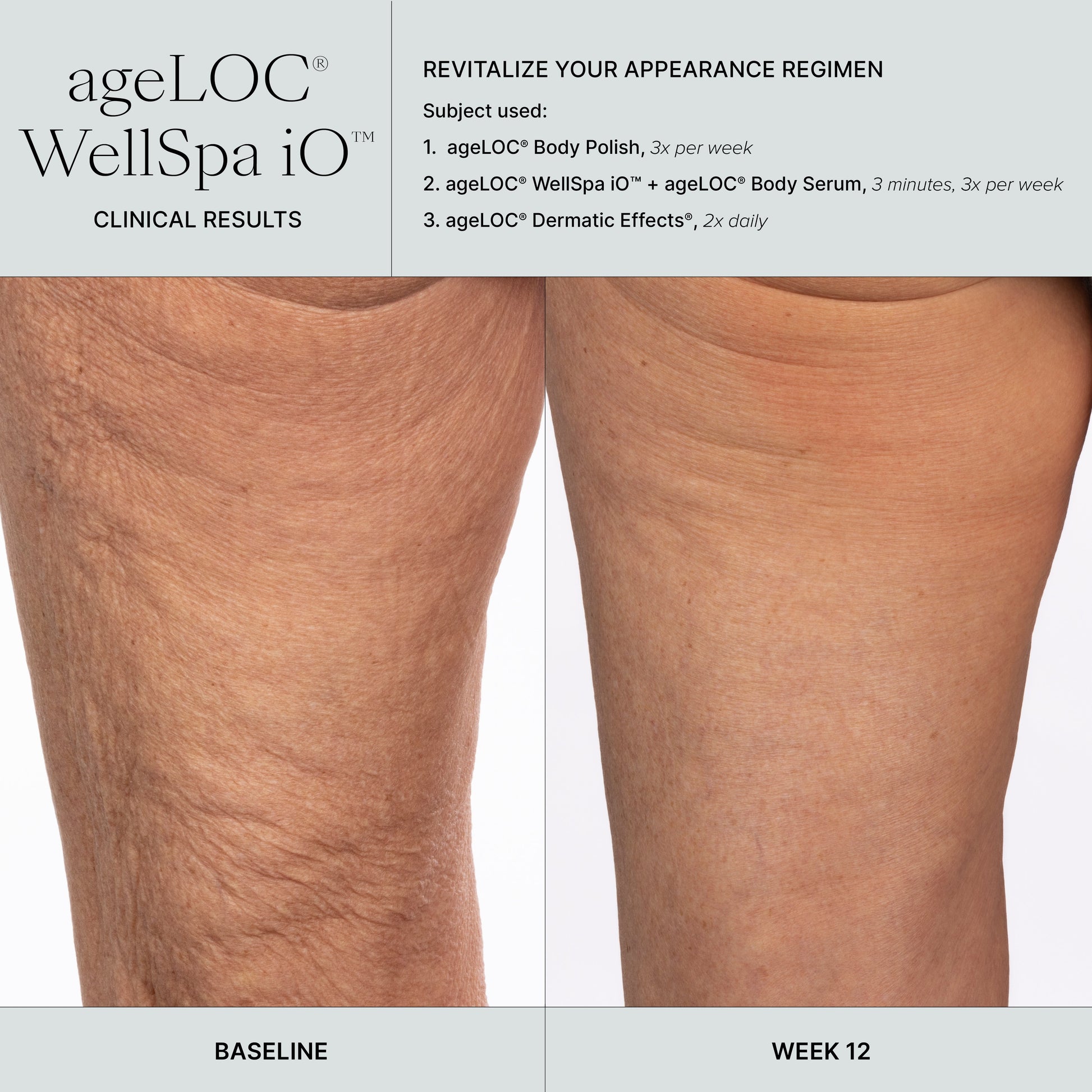 🇬🇧 Transform Your Self-Care Routine with WellSpa iO's Adaptive Microcurrent Technology - nustylemom