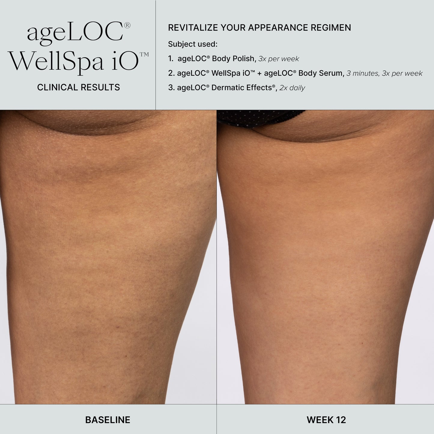 🇬🇧 Transform Your Self-Care Routine with WellSpa iO's Adaptive Microcurrent Technology - nustylemom