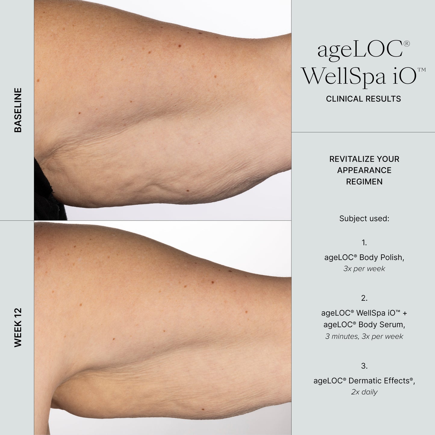 🇬🇧 Transform Your Self-Care Routine with WellSpa iO's Adaptive Microcurrent Technology - nustylemom