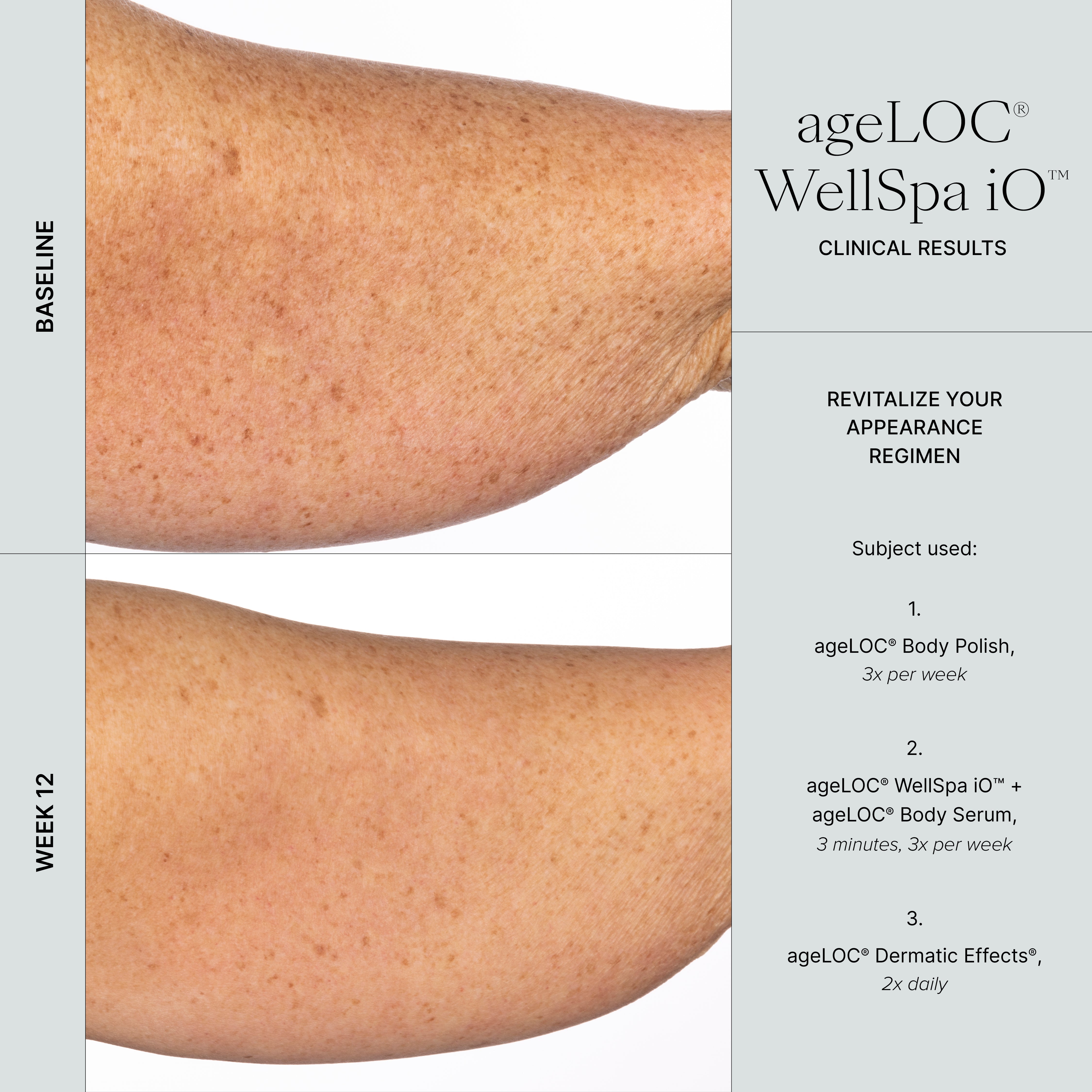 🇨🇦 ageLOC WellSpa iO + Beauty and Wellness Bundle
