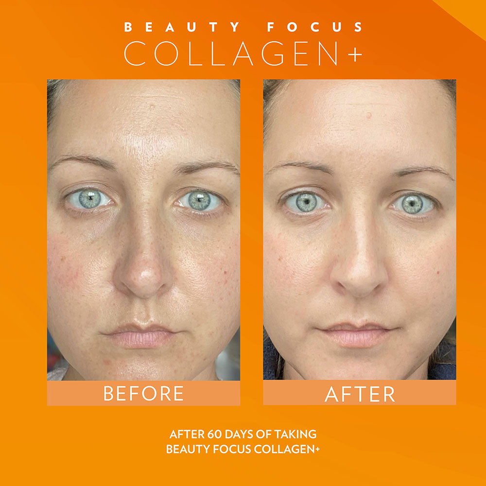 BEFORE & AFTER  Beauty Focus™ Collagen+ (Peach)Buy with Regular Price* Discount will apply at checkout.  Kickstart collagen and elastin production, rev up radiance, visibly reduce fine lines and wrinkles, and bBeauty Focus™ Collagen+ (Peach)