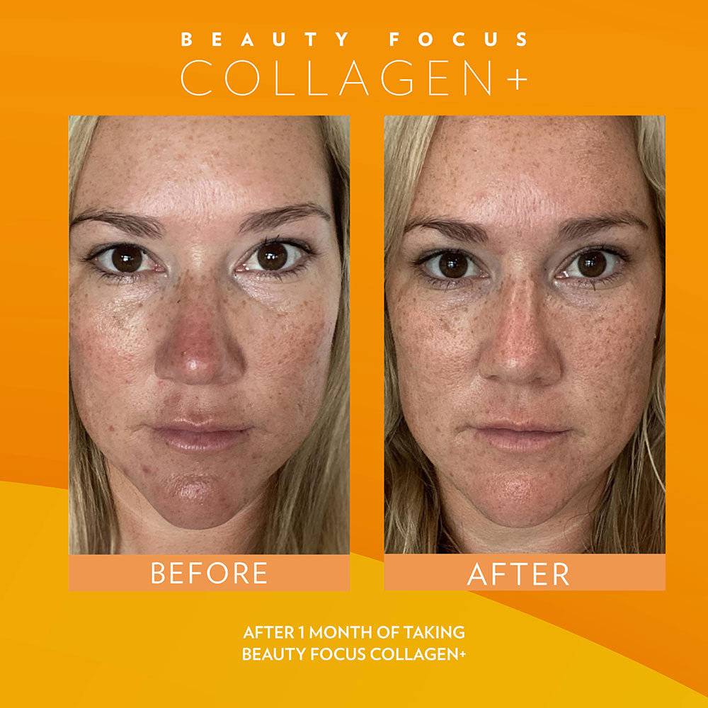 Beauty Focus™ Collagen + CelltrexBuy
* Discount will apply at checkout. 
 Kickstart collagen and elastin production, rev up radiance, visibly reduce fine lines and wrinkles, and boost hydration for Beauty Focus™ Collagen + Celltrex Always Right Recovery Fluid Subscrip